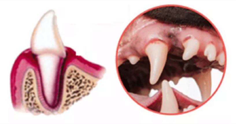 Periodontal disease